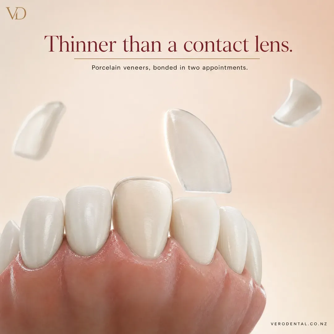 Concept advertisement for Vero Dental, an invented clinic. Oxblood serif on peach cream, gold hairline and monogram.