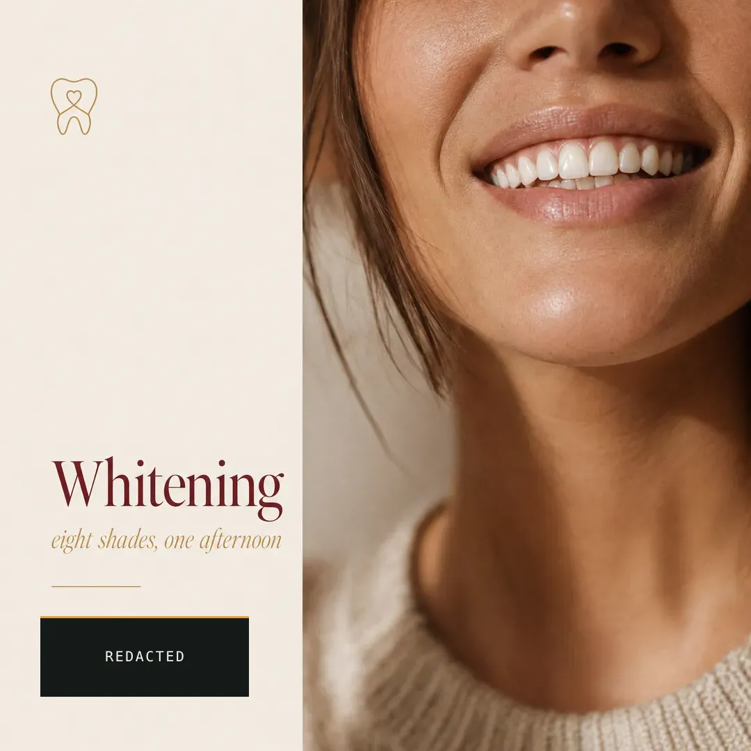 Concept advertisement for Vero Dental, an invented clinic. Macro render of a porcelain shell, lit like a product still.